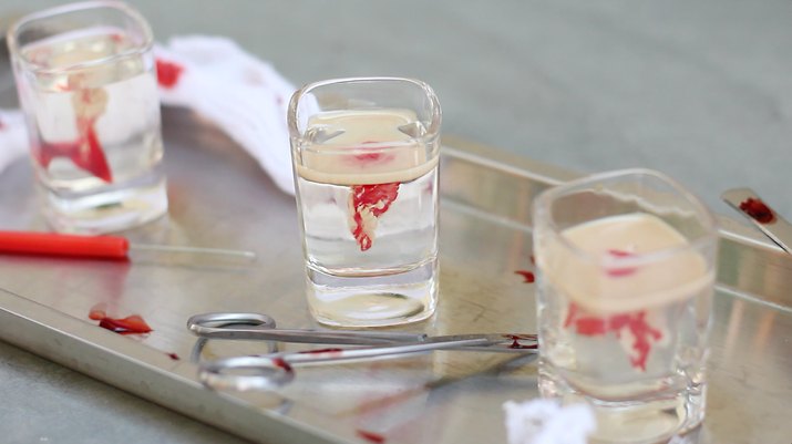 Brain hemorrhage Jello shots