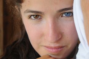 Nurcan Atli was born with heterochromia iridis, which caused her eyes to be different colors. 